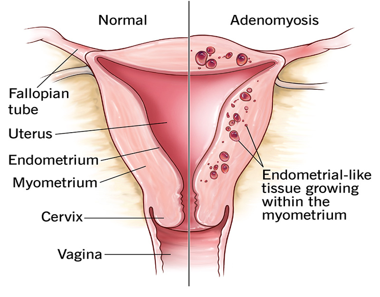 gynecology service